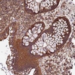 Mitochondrial ribonuclease P protein 3 Antibody, Novus Biologicals 25 &mu;L,